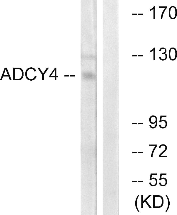 ADCY4 / Adenylate Cyclase 4 Antibody (aa195-244)
