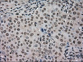 HSPA9 / Mortalin / GRP75 Antibody (clone OTI9F8)