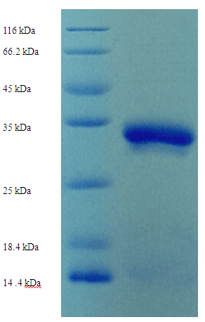 Drosophila melanogaster Ubc6 Protein (Recombinant His-SUMO)