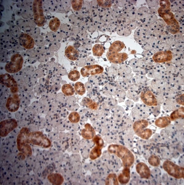 NGF Antibody (aa130-180)