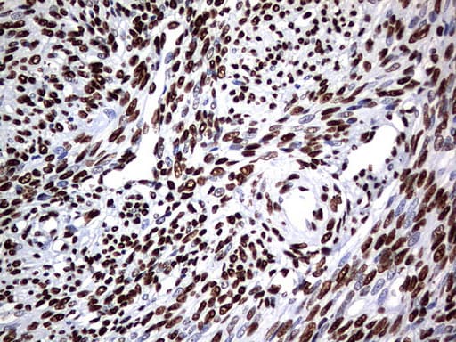 HNRPM / HNRNPM Antibody (aa1-261, clone OTI6H7)