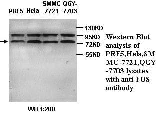 FUS / TLS Antibody (C-Terminus)