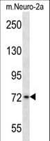 PLK3 Antibody (aa33-61)