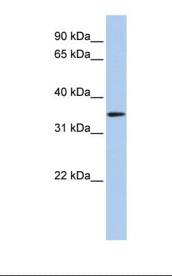 HADH Antibody (C-Terminus)