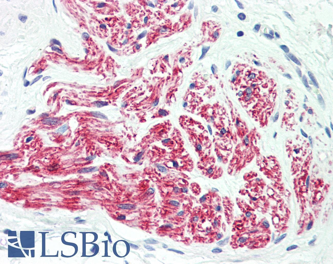 IHC-plus™ L1CAM Antibody (aa1154-1182)