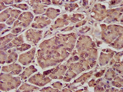 SDCCAG3 Antibody
