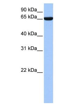 ZNF891 Antibody (aa92-141)