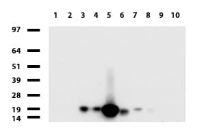 Monoclonal Mouse anti-Human VILIP / VSNL1 Antibody (clone UMAB116, aa2-191, IHC, IF, WB)