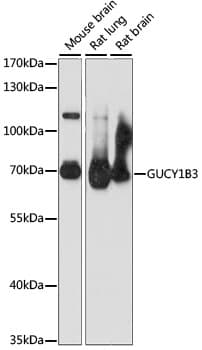 GUCY1B3 Antibody