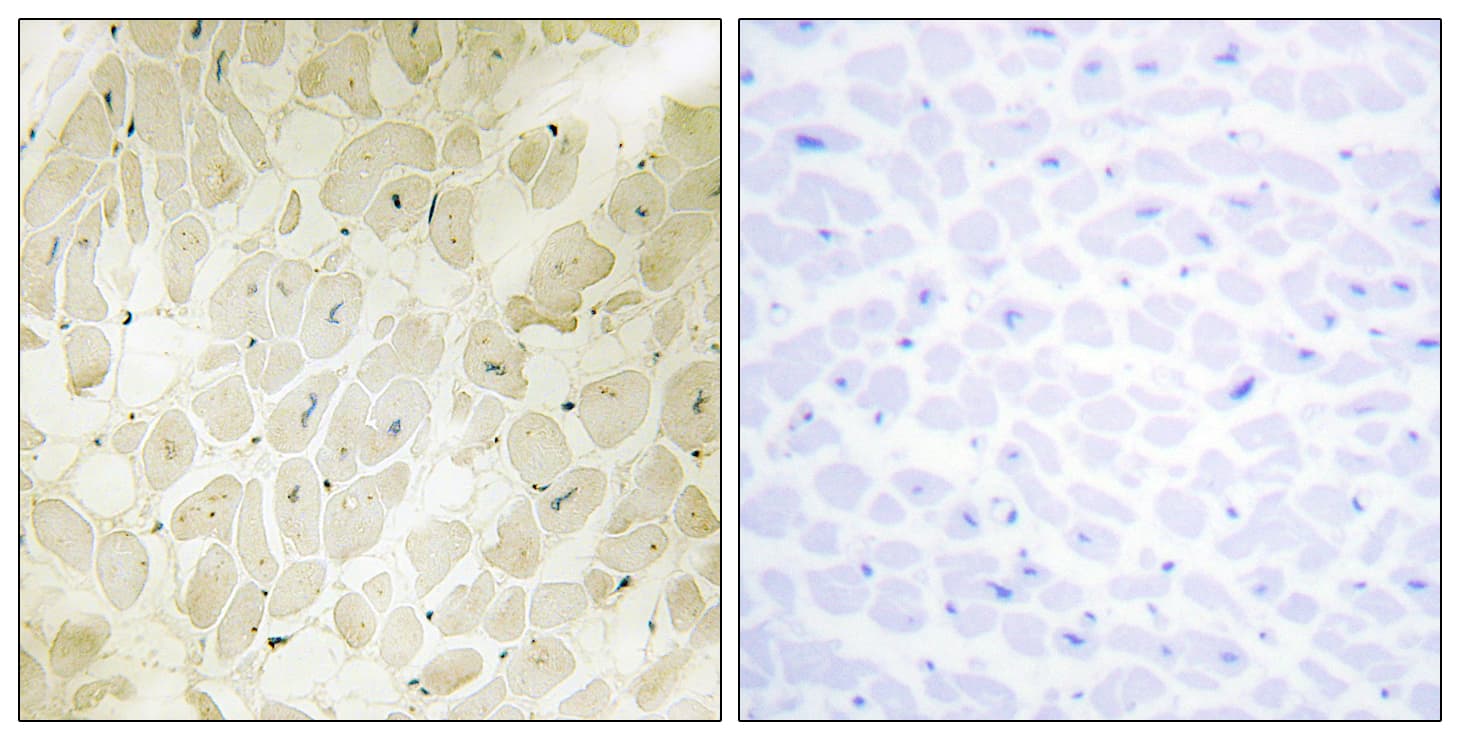 Polyclonal Rabbit anti-Human ARHGEF17 / TEM4 Antibody (IHC, IF)