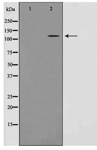 Polyclonal Rabbit anti-Human ST18 Antibody (WB)