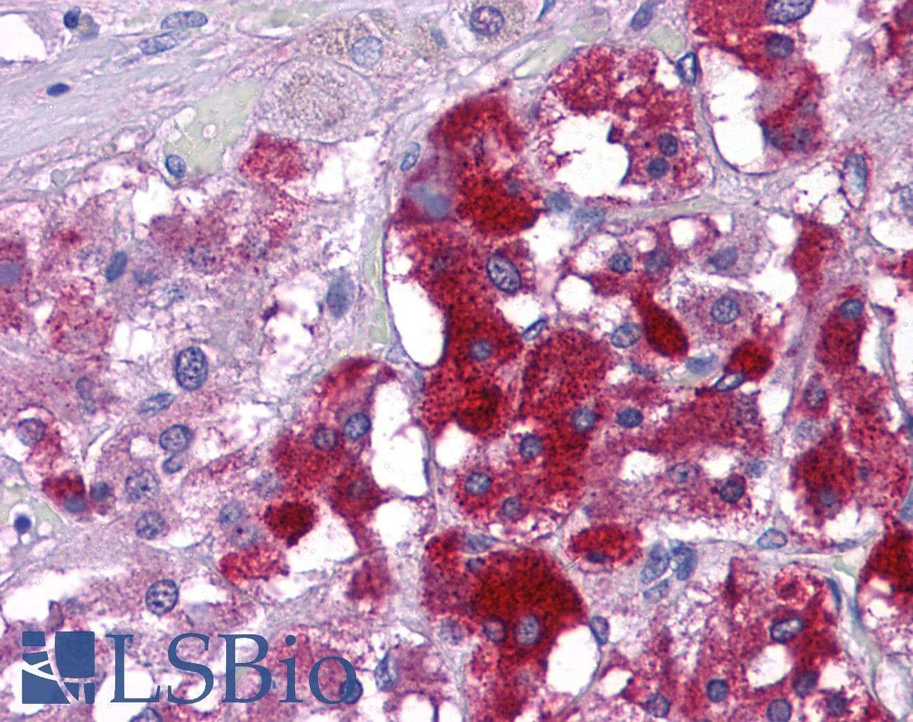 IHC-plus™ Polyclonal Rabbit anti-Human KPNA3 / Importin Alpha 4 Antibody (IHC, IF, WB)
