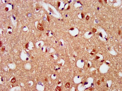 Polyclonal Rabbit anti-Human SIM2 Antibody (IHC)