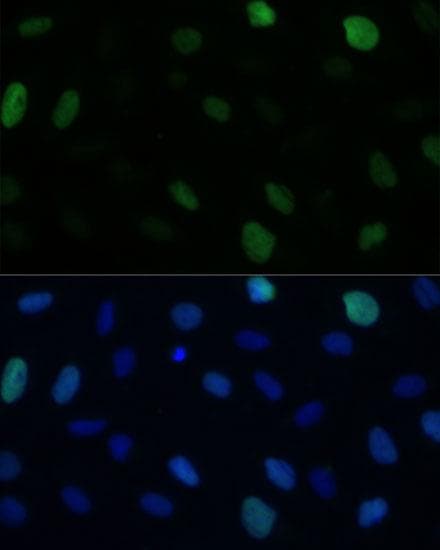 HSET / KIFC1 Antibody