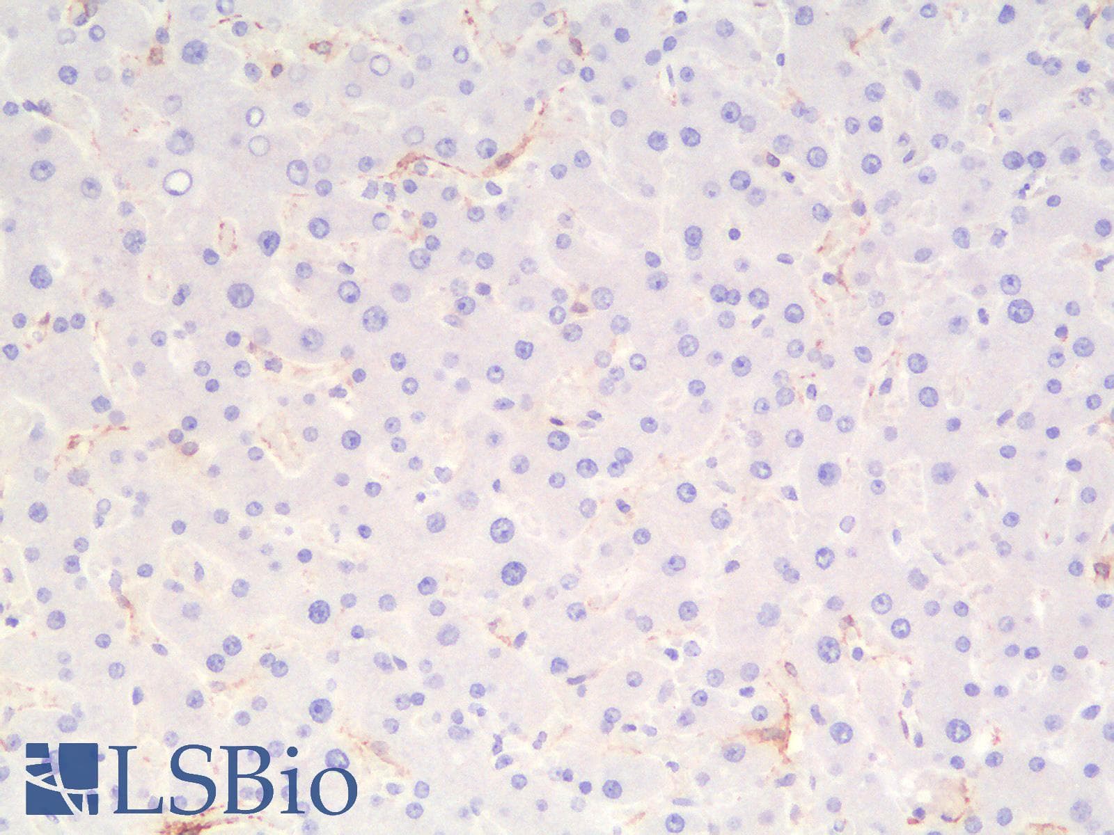 IHC-plus™ Recombinant Monoclonal Rabbit anti-Human CALD1 / Caldesmon Antibody (clone CALD1/1424R, IHC)