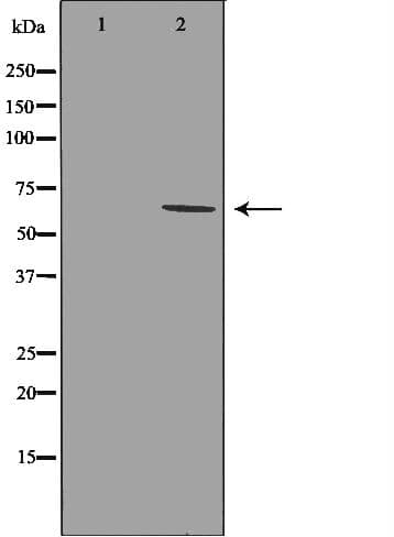 Rhodopsin Kinase / GRK1 Antibody