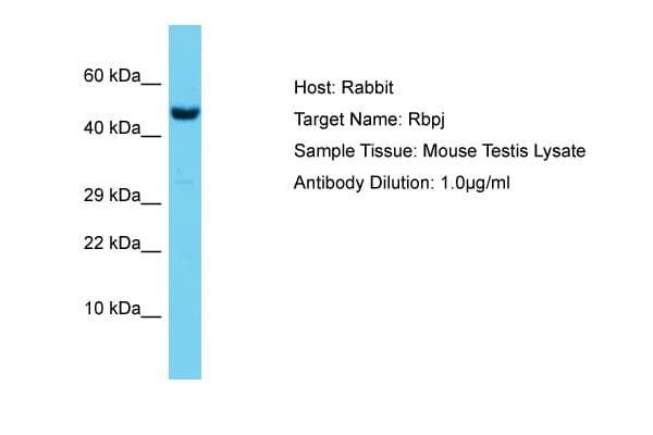 RBPJ Antibody (aa331-380)