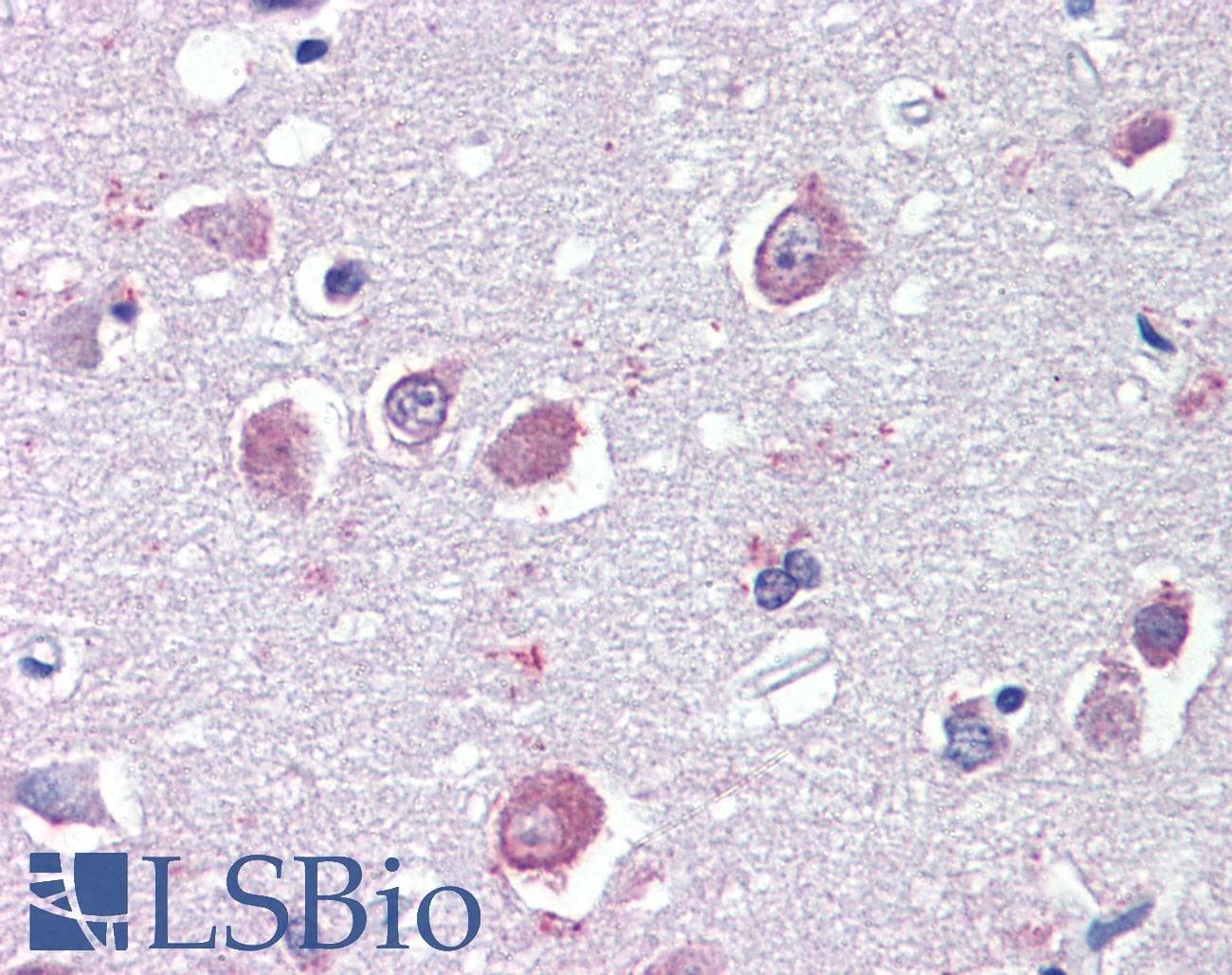 IHC-plus™ Polyclonal Goat anti-Human GABRB3 Antibody (aa400-411, IHC)