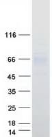Human SLC39A5 / ZIP5 Protein (Recombinant Myc-DDK (Flag))