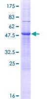 Human ZDHHC19 Protein (Recombinant GST)