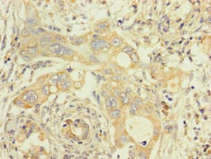 TMEM184B Antibody