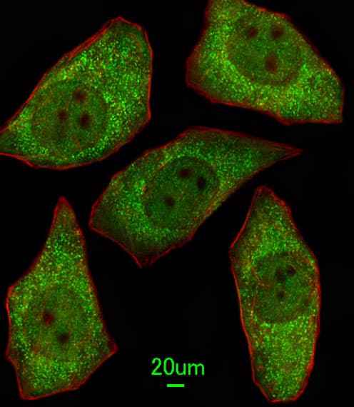 Polyclonal Rabbit anti-Human MSRA Antibody (aa34-63, IHC, IF, WB)