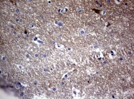 VILIP / VSNL1 Antibody (clone OTI7D6)