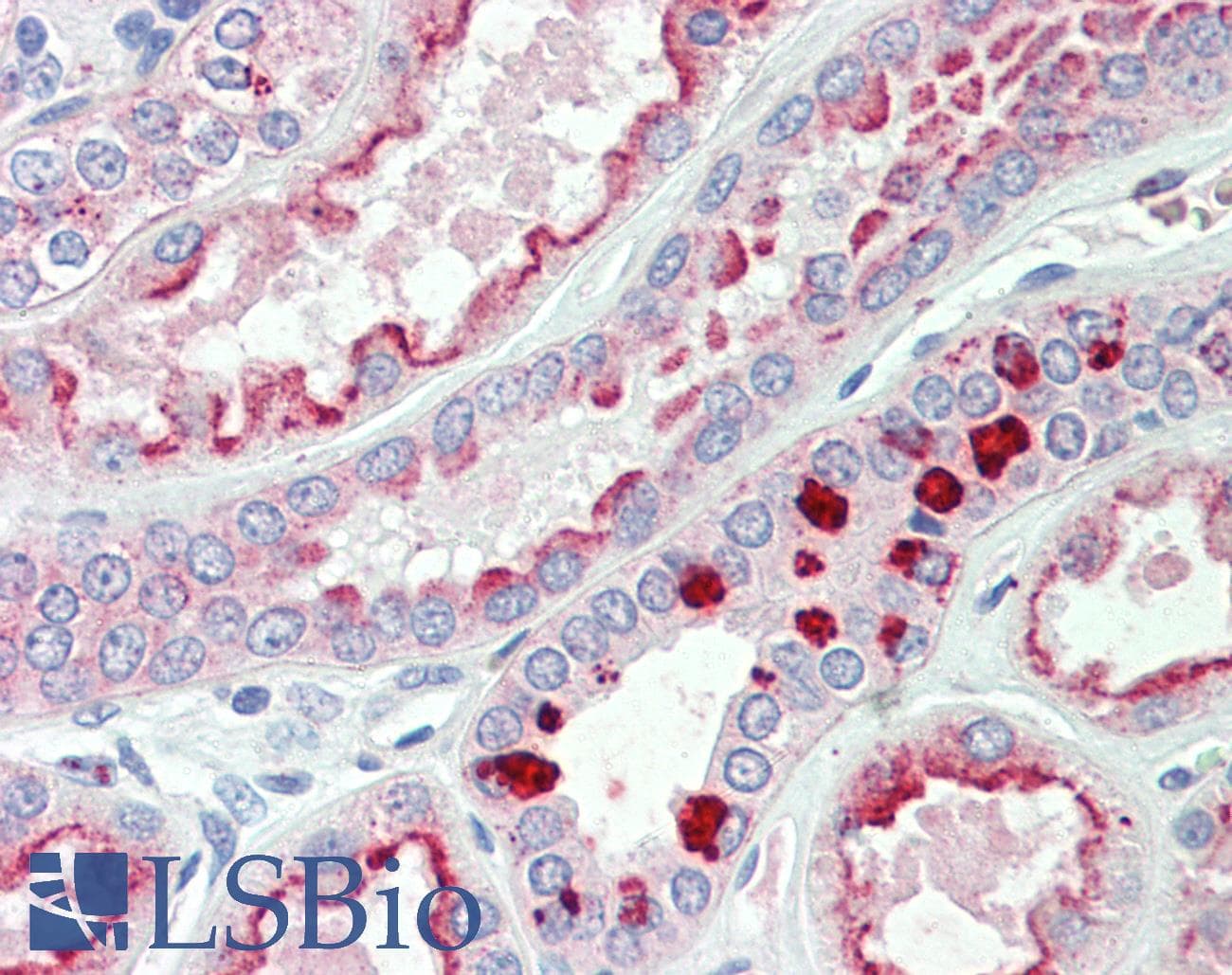 IHC-plus™ MAPKAPK5 / PRAK Antibody (aa306-318)