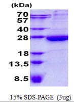 Human HEBP1 Protein (Recombinant His)