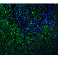IHC-plus™ Polyclonal Rabbit anti-Human VPS39 Antibody (IHC, IF, WB)