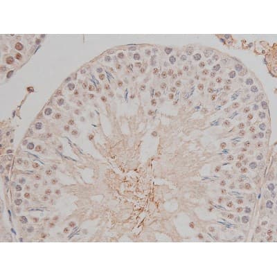 SP1 Antibody (phospho-Thr453)