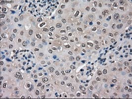 SLC18A2 / VMAT2 Antibody (clone OTI10C11, Carrier-free)