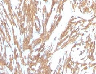 ACTA2 / Smooth Muscle Actin Antibody (clone ACTA2/791, Ready-to-Use)