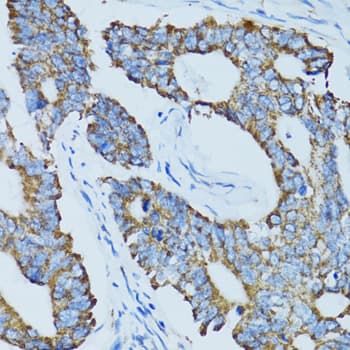 ADAMTS4 Antibody
