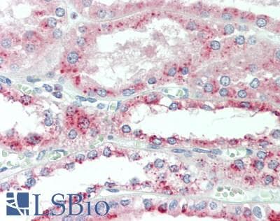 IHC-plus™ Polyclonal Rabbit anti-Human FOLR3 Antibody (aa24-53, IHC, WB)