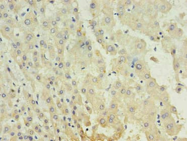 Alpha-Fetoprotein Antibody (clone 4C2A2)