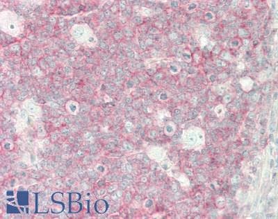 IHC-plus™ LGALS9 / Galectin 9 Antibody (clone 19H8)