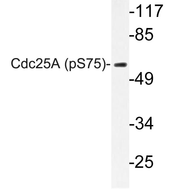 CDC25A Antibody (phospho-Ser75)