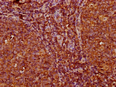 Kappa Light Chain Antibody