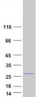 Human LRTOMT Protein (Recombinant Myc-DDK (Flag))
