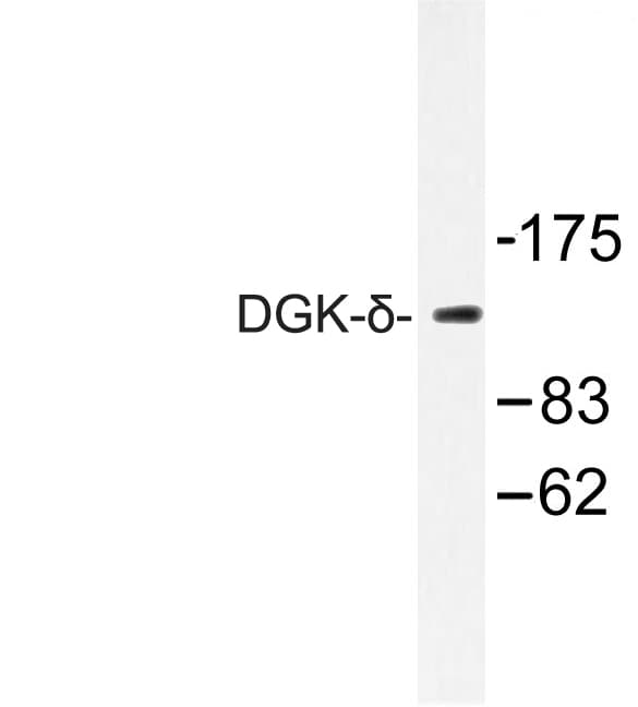 Polyclonal Rabbit anti-Human DGKD Antibody (Ser66, IHC, IF, WB)