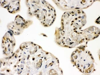 GRK5 Antibody
