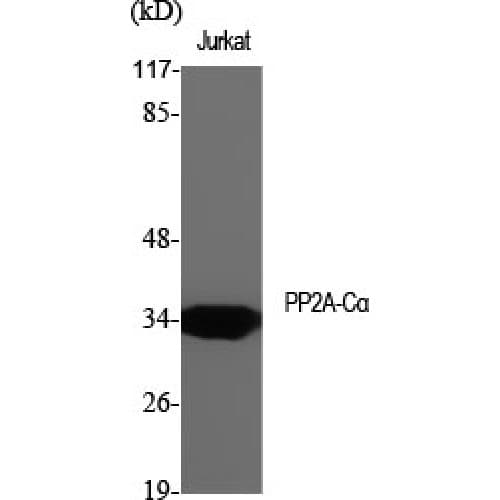 PP2Ac / PPP2CA Antibody (250-330 aa)