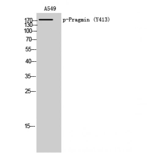 PRAGMIN / SGK223 Antibody (phospho-Tyr413)