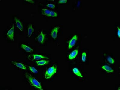IHC-plus™ BCAP31 / BAP31 Antibody (aa 2-234)