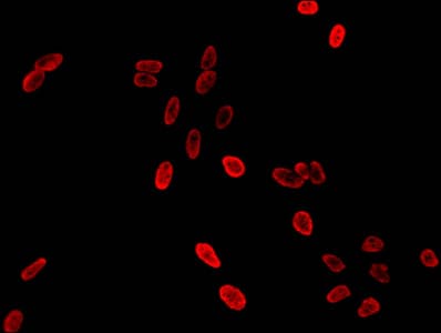 Polyclonal Rabbit anti-Human HIST1H3A Antibody (IHC, IF)