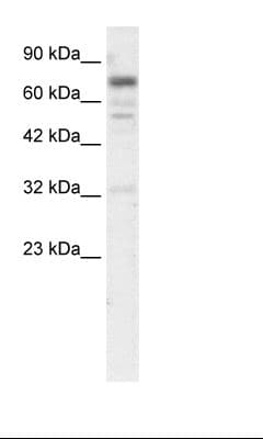 RIN3 Antibody (aa82-131)