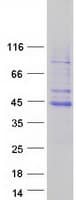 Human TFB2M Protein (Recombinant Myc-DDK (Flag))
