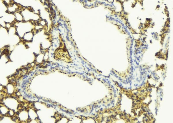 PDE4D Antibody (aa703-722)