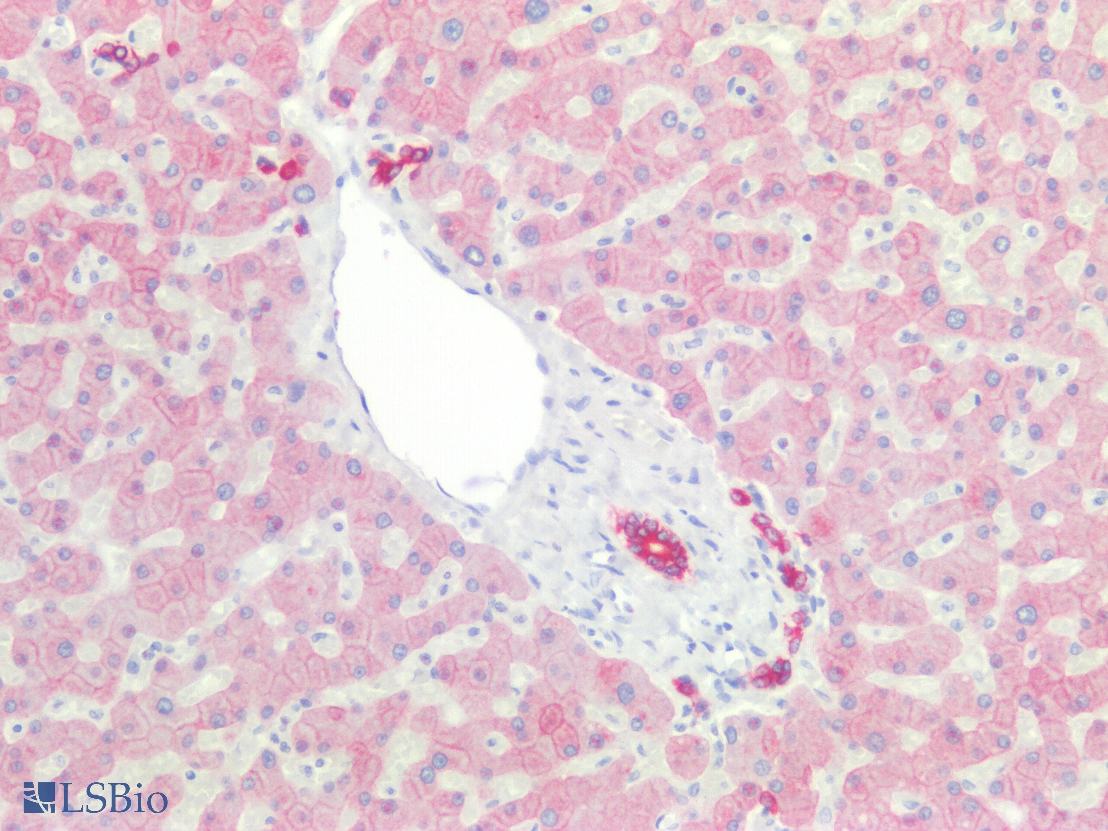 PathPlus™ KRT18 / CK18 / Cytokeratin 18 Antibody